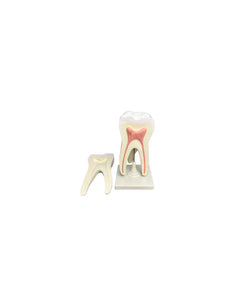 modelo anatomico muela dental